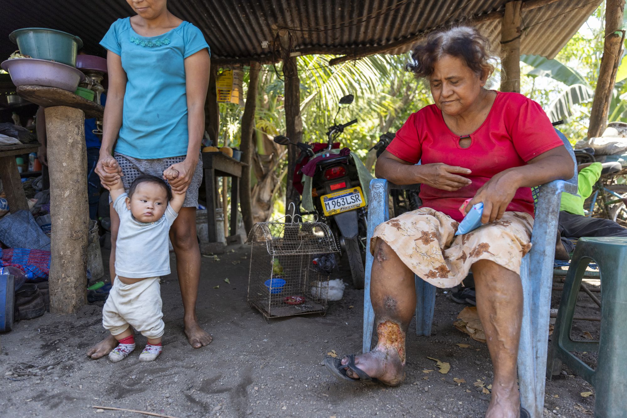 Edvin Rafael Sarmiento, 32, a former sugar cane worker who contracted kidney disease 6 years ago, and has been unable to work, at his home with family in Parselamiento El Cajon in sector Aguero, Guatemala on March 2, 2026.